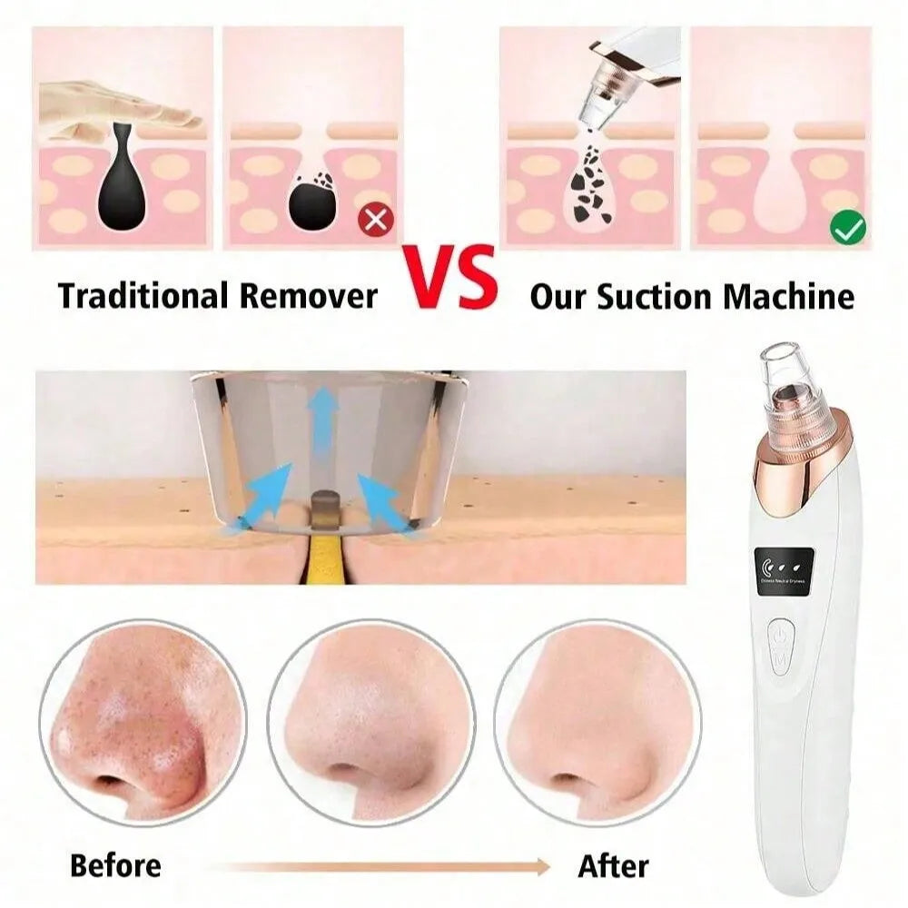 Electric Blackhead Remover – Pore Vacuum & Acne Suction Cleaner