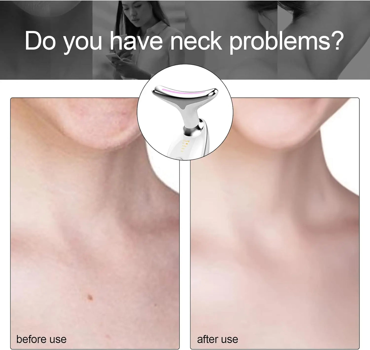 EMS Face & Neck Massager – Photon Therapy Lifting & Slimming Device