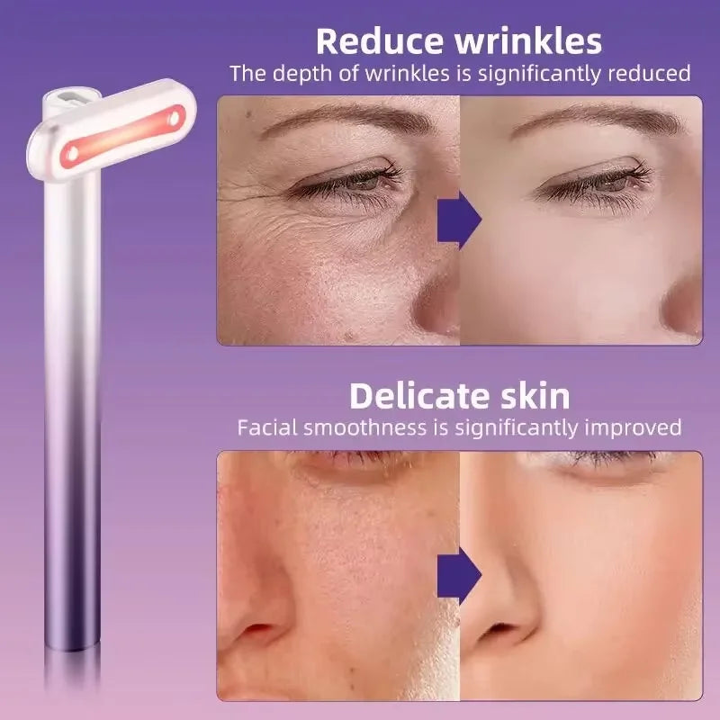 4-in-1 Eye Massager Wand – EMS & LED