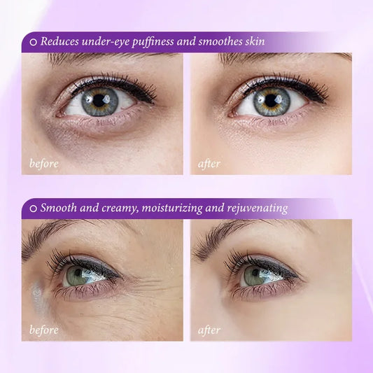 Crème contour des yeux au rétinol et Pro-Xylane – vue 2