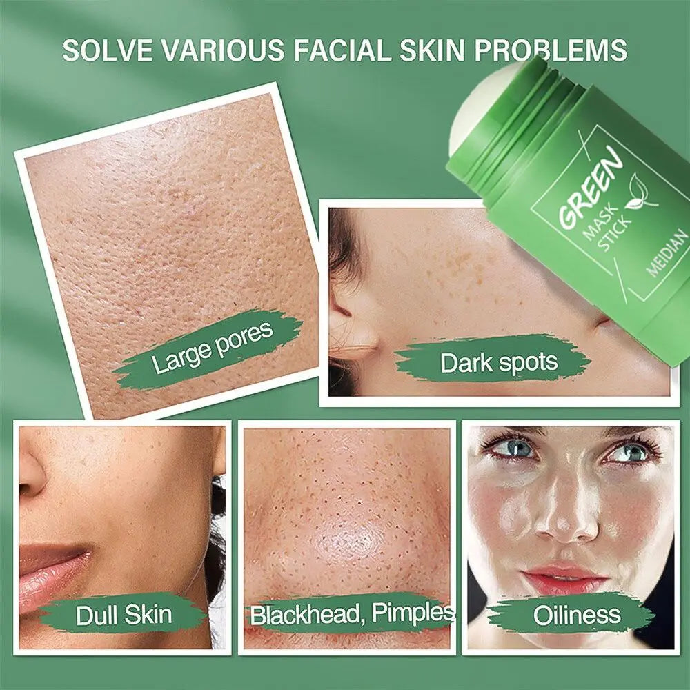 Green Tea Blackhead Remover Stick – Acne & Pore Care RIAZ EXPRESS.COM