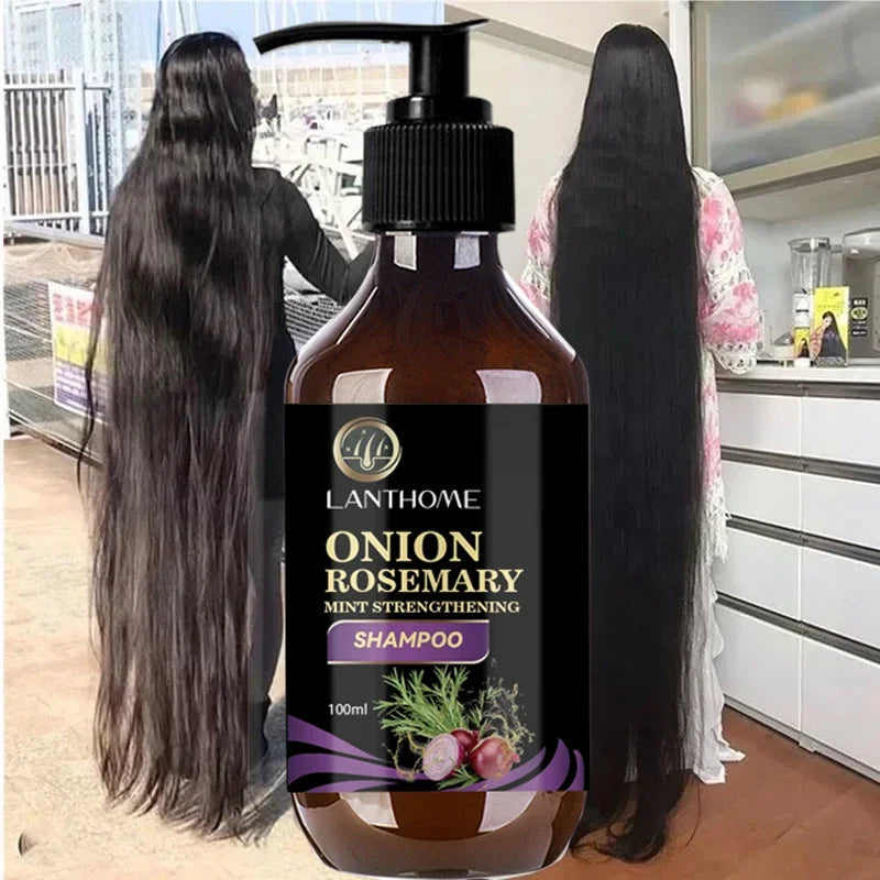 Onion & Rosemary Hair Regrowth riazexpress