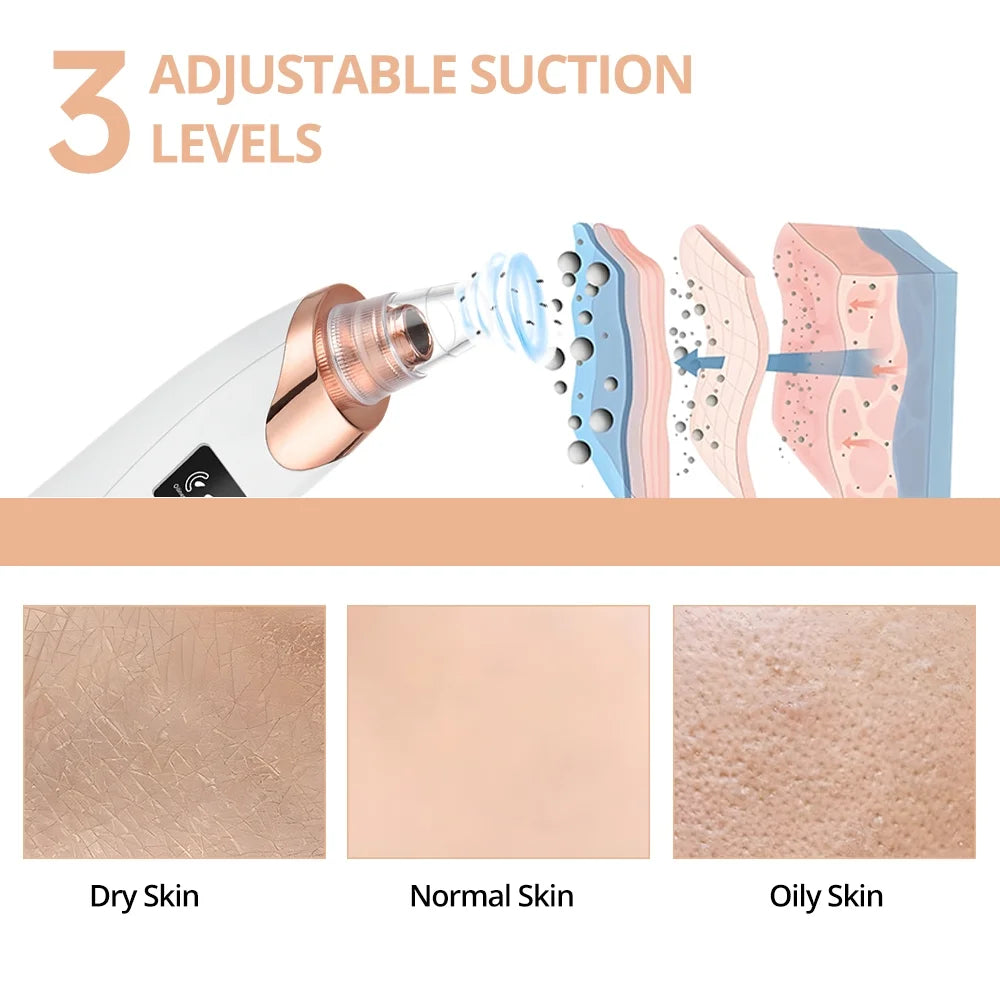 Blackhead Remover Vacuum - Facial Pore Cleaner with 5 Attachments, Electric USB Pore Vacuum