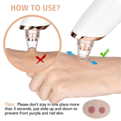 Blackhead Remover Vacuum - Facial Pore Cleaner with 5 Attachments, Electric USB Pore Vacuum