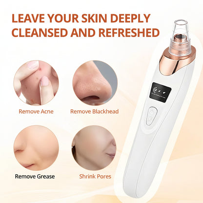 Blackhead Remover Vacuum - Facial Pore Cleaner with 5 Attachments, Electric USB Pore Vacuum