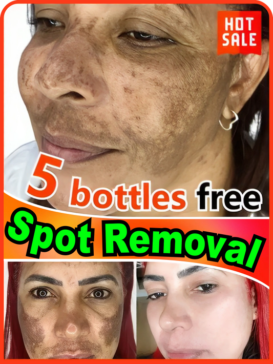 Face Spot Removal Serum