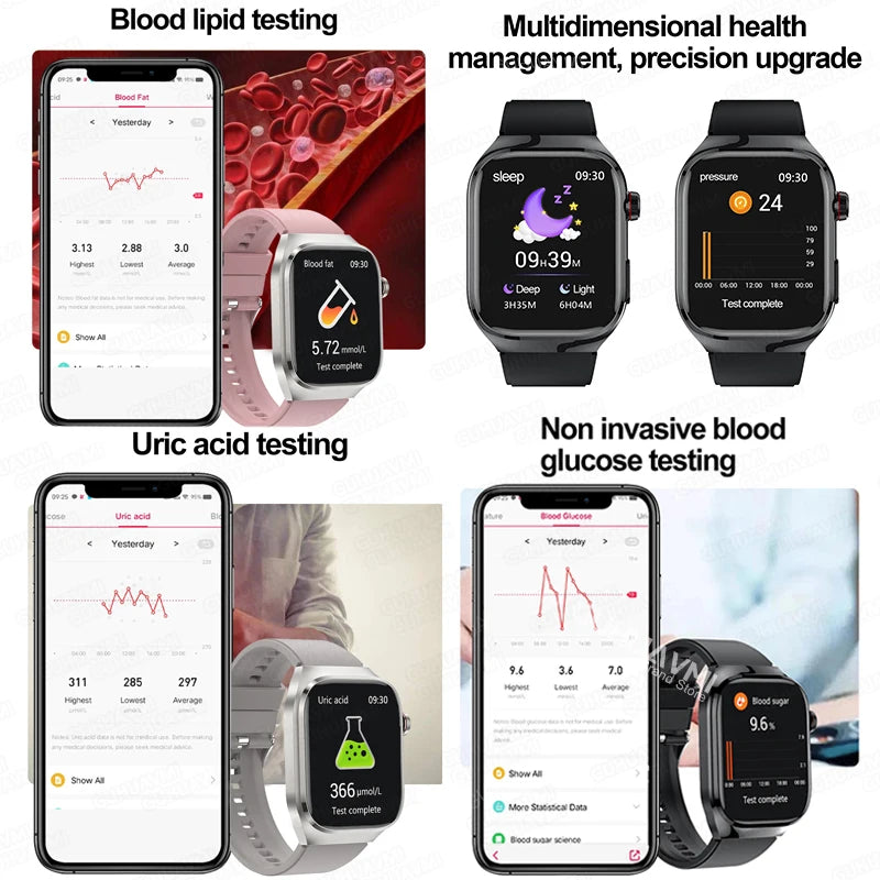 Uric Acid & Health Monitoring Smartwatch – Your All-in-One Health Companion