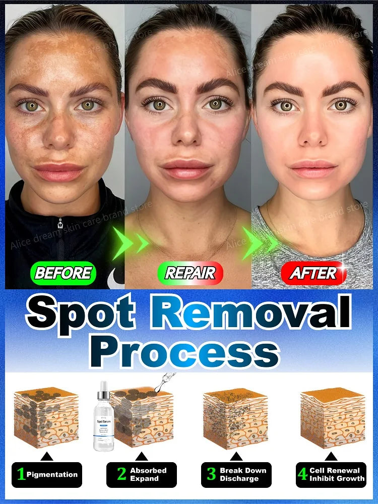 Face Spot Removal Serum