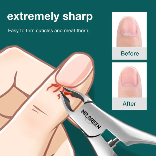 Stainless Steel Cuticle Nippers – Dead Skin Remover Tool