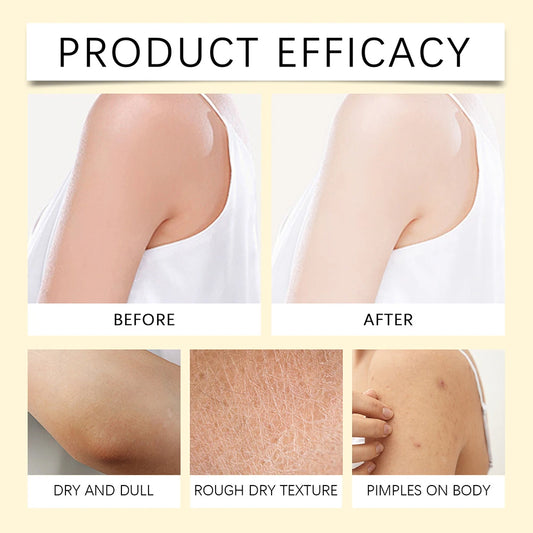 Bee Venom Face & Body Cream