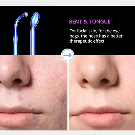 DARSONVAL 6-in-1 High Frequency Facial Machine