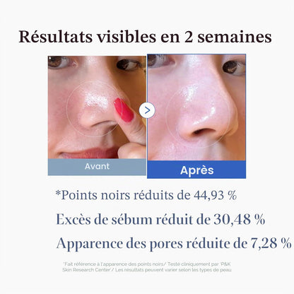 Zero Pore Pads 2.0, Tonifiants Pour Le Visage À Double Texture Pour L'Exfoliation Et Le Soin Des Pores Avec 4,5% D'Acide Lactique Aha (70 Unidades)