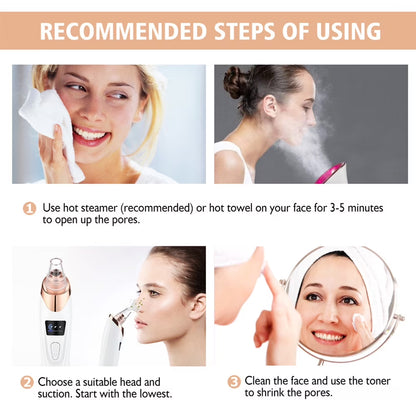Blackhead Remover Vacuum - Facial Pore Cleaner with 5 Attachments, Electric USB Pore Vacuum