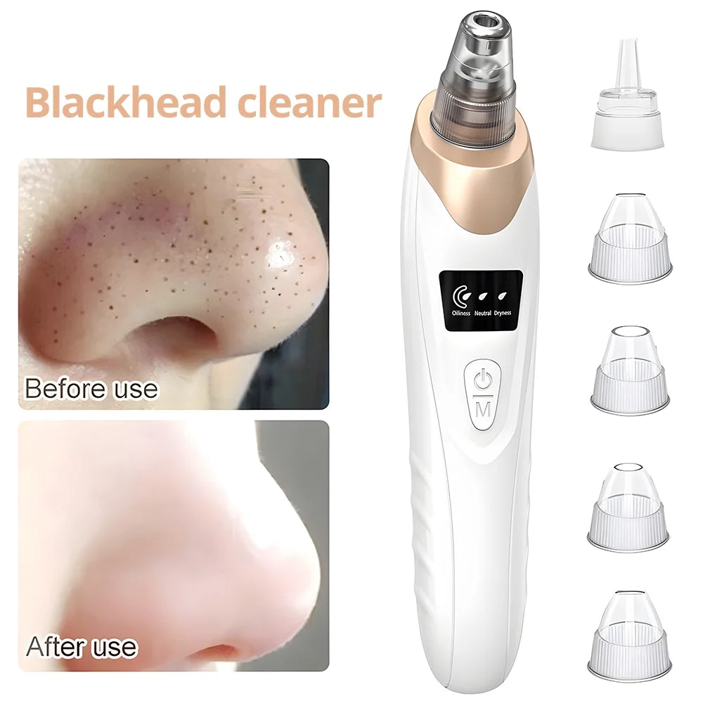 Blackhead Remover Vacuum - Facial Pore Cleaner with 5 Attachments, Electric USB Pore Vacuum