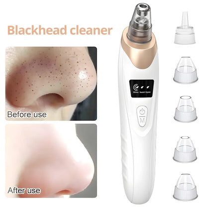 Blackhead Remover Vacuum - Facial Pore Cleaner with 5 Attachments, Electric USB Pore Vacuum